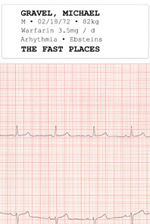Cover of The Fast Places